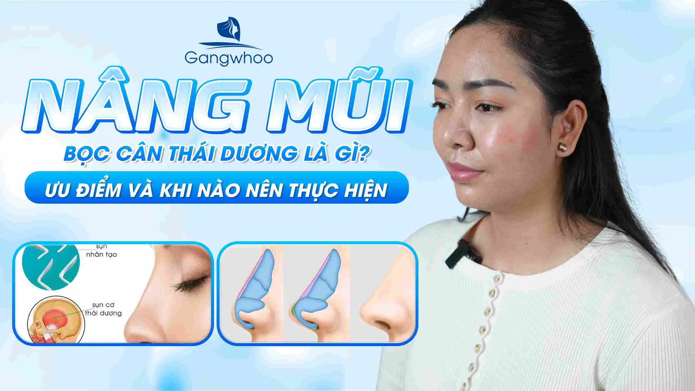 Nâng Mũi Bọc Cân Thái Dương Là Gì? Ưu Điểm Và Khi Nào Nên Thực Hiện