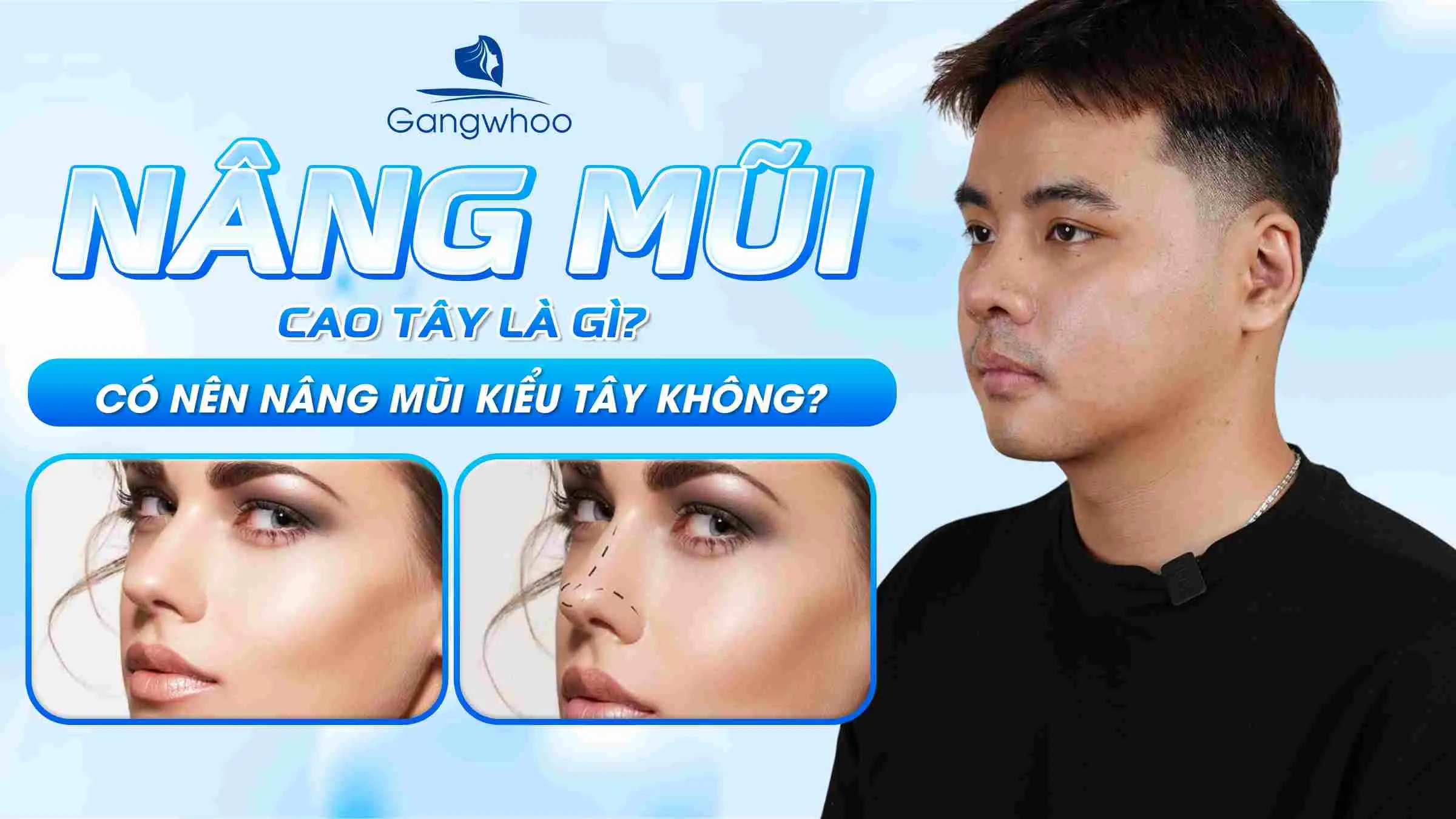 Nâng Mũi Cao Tây Là Gì? Có Nên Nâng Mũi Kiểu Tây Không?