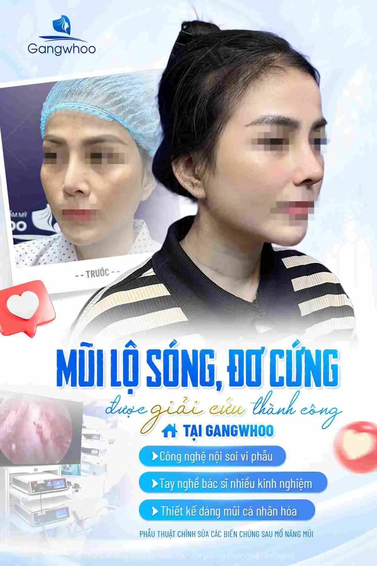Vì sao nên kiêng thịt trâu trong thời gian đầu?