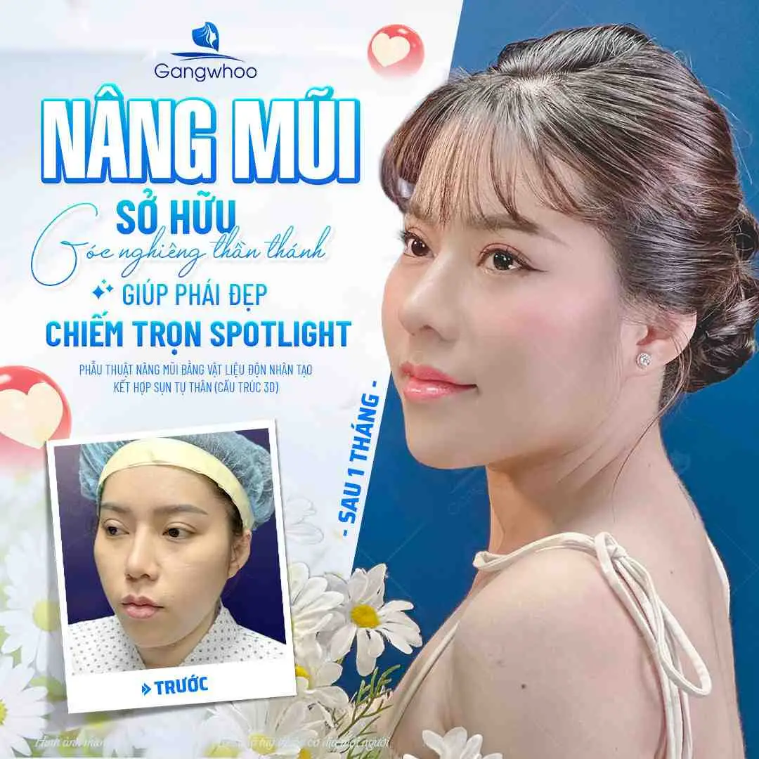 Những món ăn cần tránh khác ngoài thịt trâu mà bạn cần lưu ý