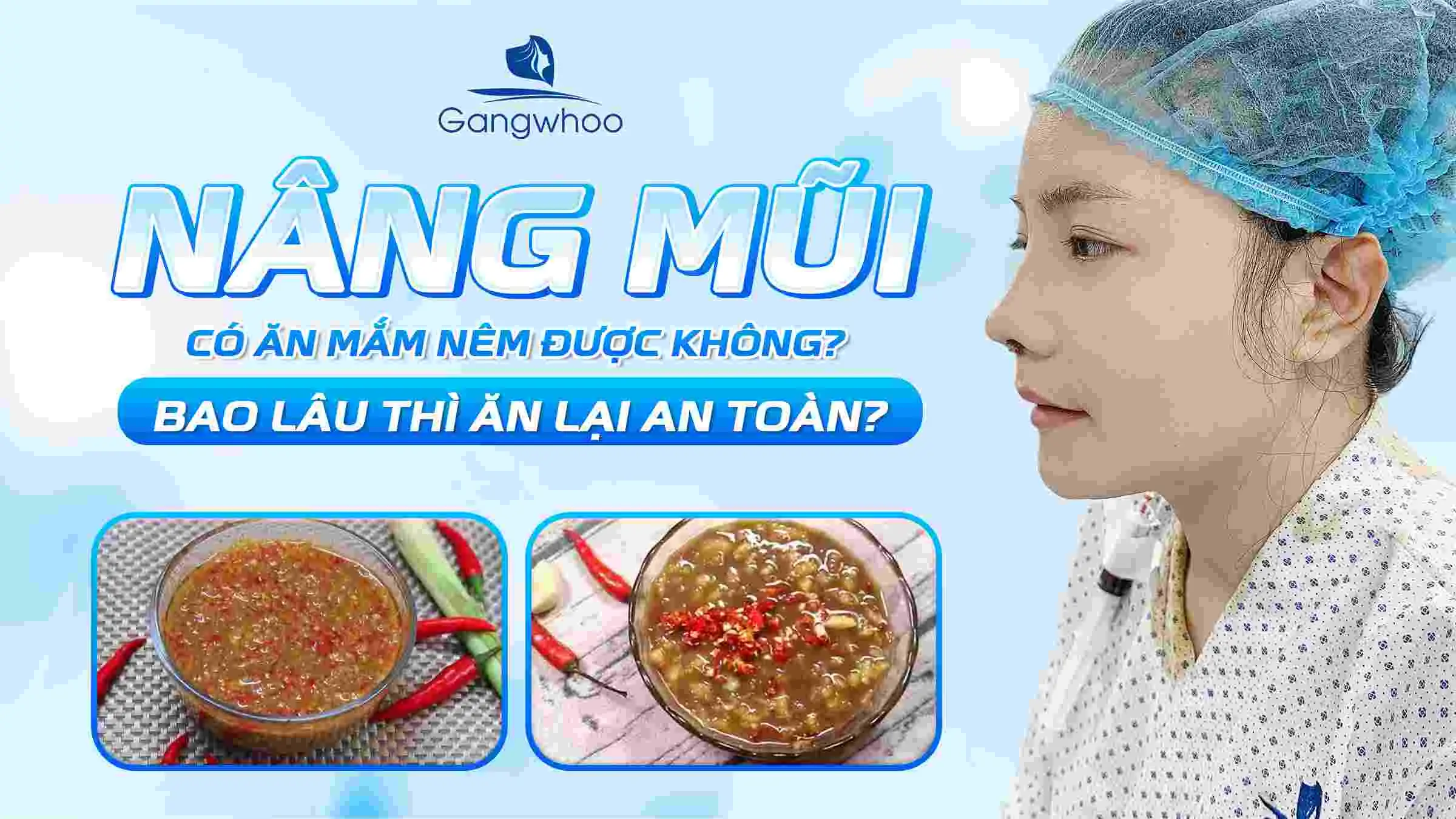 Nâng Mũi Có Ăn Mắm Nêm Được Không? Bao Lâu Thì Ăn Lại An Toàn?