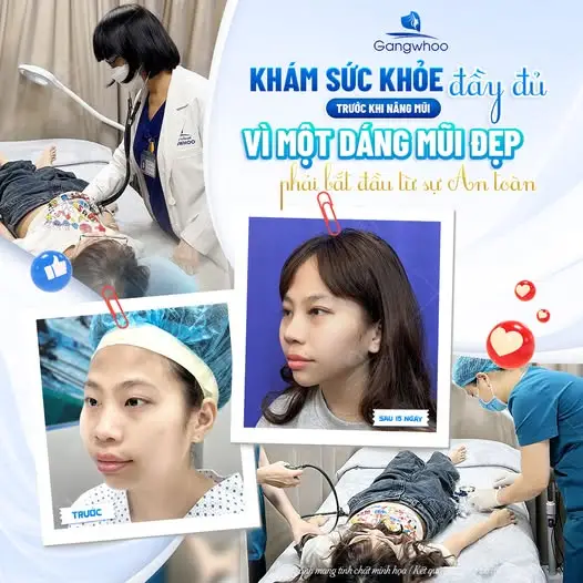 Nếu muốn đổi CCCD sau khi nâng mũi thì cần làm gì?