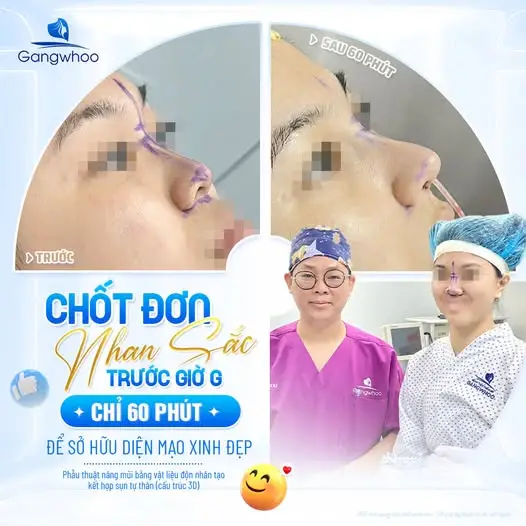 Sau nâng mũi nên ăn dưa hấu như thế nào?
