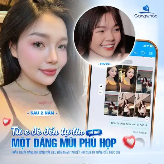 Sau khi nâng mũi nên ăn bánh bông lan như thế nào?