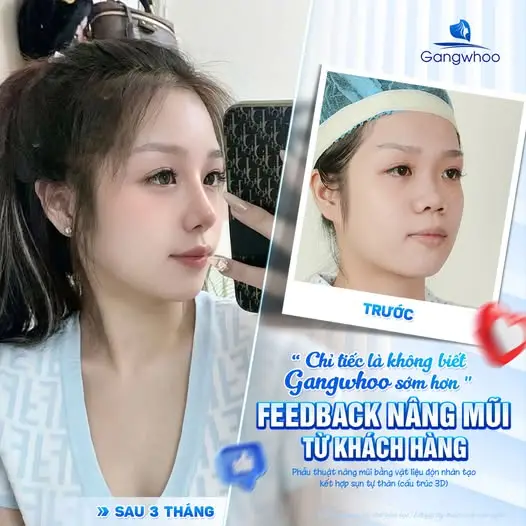 Những thực phẩm cần hạn chế trong thời gian đầu