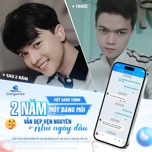 Sau nâng mũi kiêng ăn hải sản bao lâu?