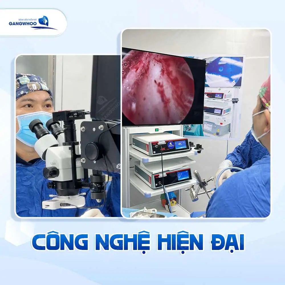 Thẩm mỹ viện Gangwhoo hiện được nhiều khách hàng quan tâm nhờ ứng dụng công nghệ nâng mũi hiện đại
