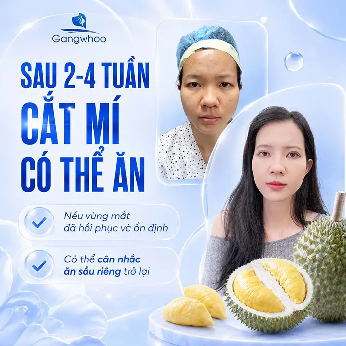 Cắt Mí Mắt Ăn Sầu Riêng Được Không? Giải Đáp Từ Bác Sĩ Thẩm Mỹ