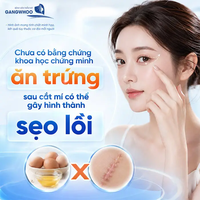 Cắt Mí Mắt Ăn Sầu Riêng Được Không? Giải Đáp Từ Bác Sĩ Thẩm Mỹ