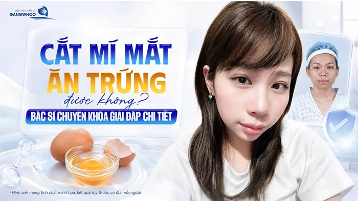 Cắt Mí Mắt Ăn Sầu Riêng Được Không? Giải Đáp Từ Bác Sĩ Thẩm Mỹ