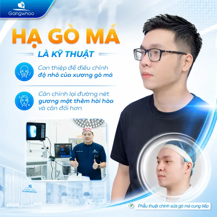 Phẫu Thuật Hạ Gò Má Có Được Vĩnh Viễn Không? Giữ Được Bao Lâu?