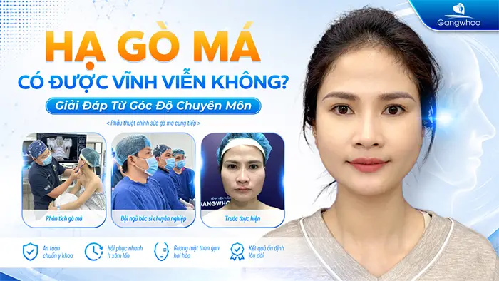 Phẫu Thuật Hạ Gò Má Có Được Vĩnh Viễn Không? Giữ Được Bao Lâu?