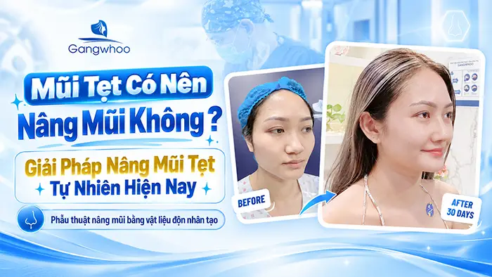 Mũi Tẹt Có Nên Nâng Không? Giải Pháp Nâng Mũi Tẹt Tự Nhiên Hiện Nay