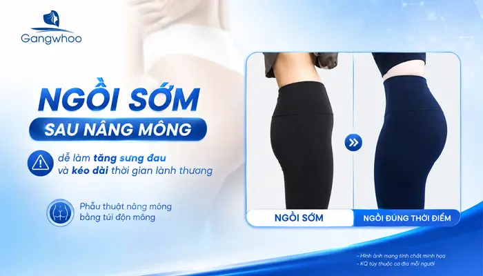 Nâng Mông Bao Lâu Thì Ngồi Được? Hướng Dẫn Cách Ngồi Đúng Tư Thế