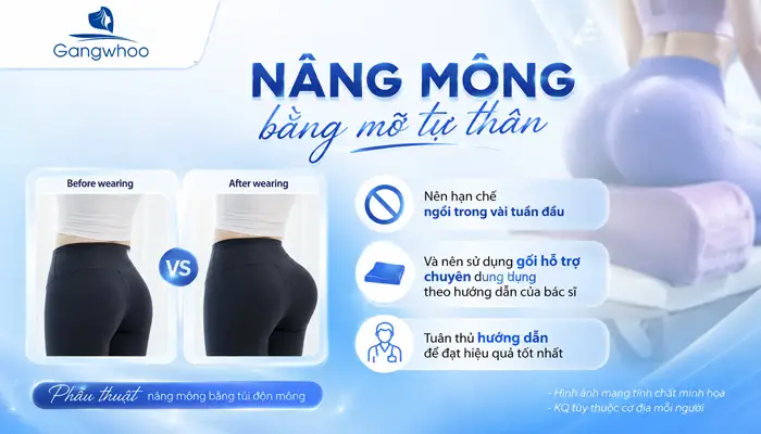 Nâng Mông Bao Lâu Thì Ngồi Được? Hướng Dẫn Cách Ngồi Đúng Tư Thế