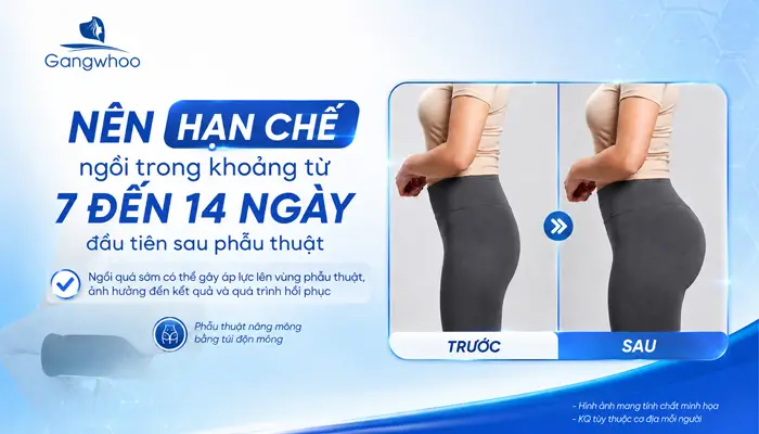 Nâng Mông Bao Lâu Thì Ngồi Được? Hướng Dẫn Cách Ngồi Đúng Tư Thế