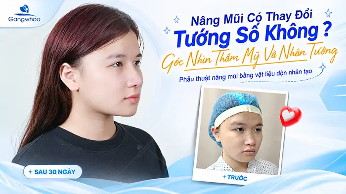 Nâng Mũi Có Thay Đổi Tướng Số Không? Góc Nhìn Thẩm Mỹ Và Nhân Tướng