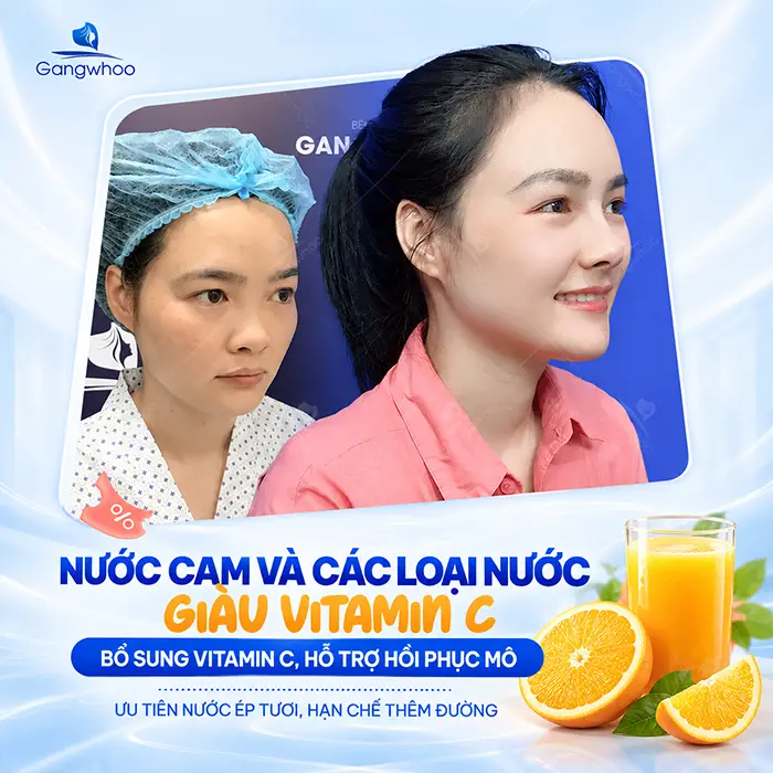 Nâng Mũi Uống Gì Mau Lành? Gợi Ý Thức Uống Hỗ Trợ Hồi Phục Tốt Hơn