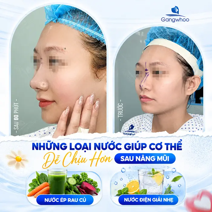 Nâng Mũi Uống Gì Mau Lành? Gợi Ý Thức Uống Hỗ Trợ Hồi Phục Tốt Hơn