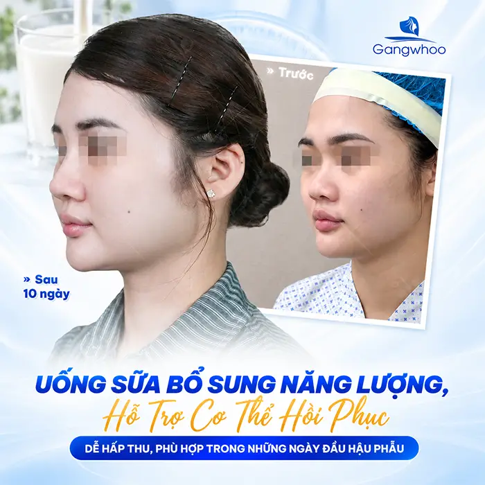 Nâng Mũi Uống Gì Mau Lành? Gợi Ý Thức Uống Hỗ Trợ Hồi Phục Tốt Hơn