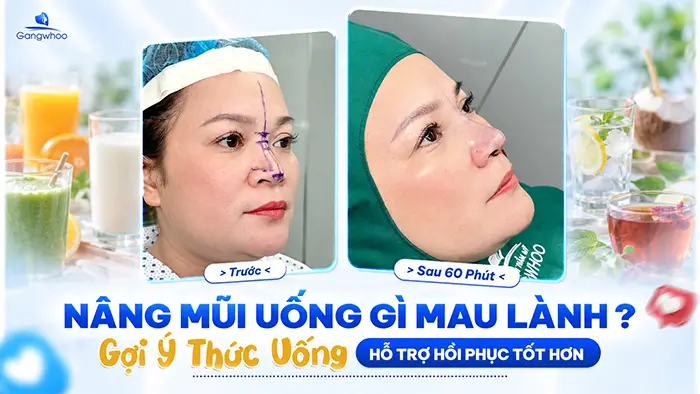 Nâng Mũi Uống Gì Mau Lành? Gợi Ý Thức Uống Hỗ Trợ Hồi Phục Tốt Hơn