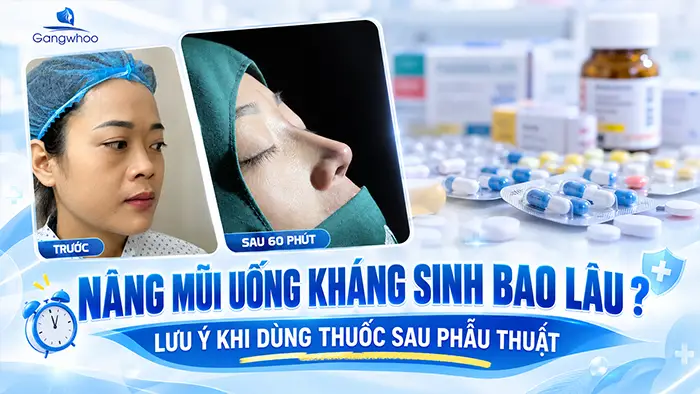 Nâng Mũi Uống Kháng Sinh Bao Lâu? Lưu Ý Khi Dùng Thuốc Sau Phẫu Thuật