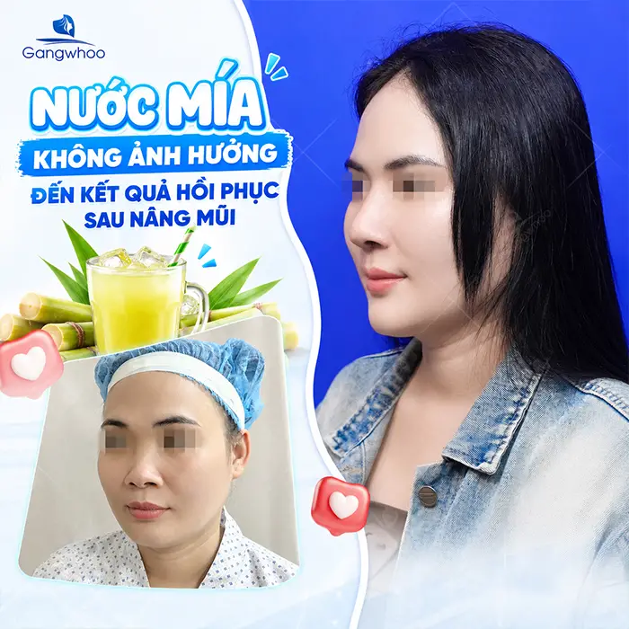 Nâng Mũi Uống Nước Mía Được Không? Có Ảnh Hưởng Hồi Phục Không?