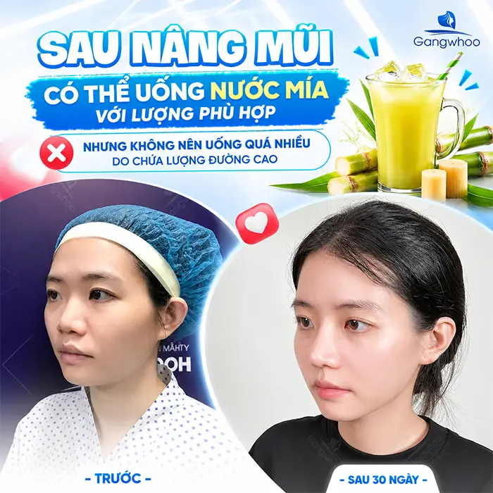 Nâng Mũi Uống Nước Mía Được Không? Có Ảnh Hưởng Hồi Phục Không?