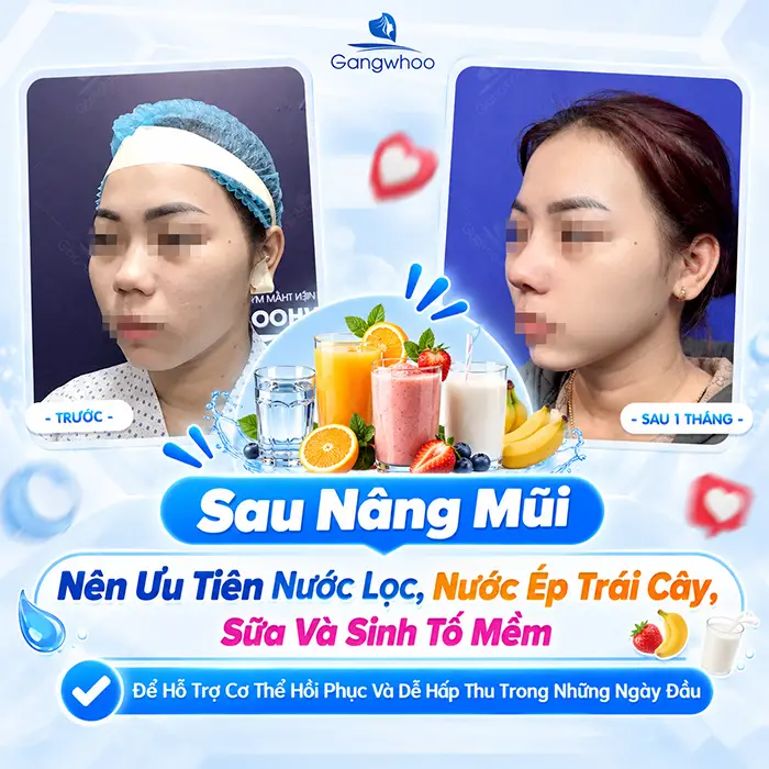 Nâng Mũi Uống Nước Ngọt Được Không? Những Lưu Ý Sau Phẫu Thuật
