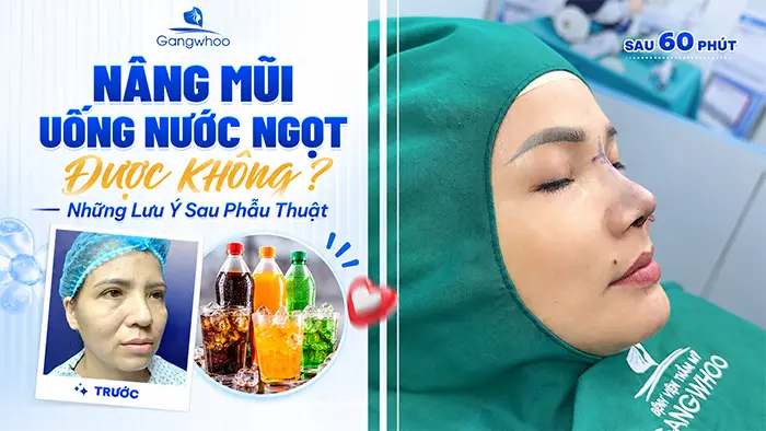 Nâng Mũi Uống Nước Ngọt Được Không? Những Lưu Ý Sau Phẫu Thuật