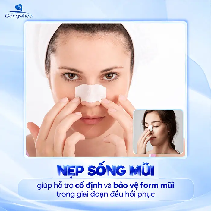 Nẹp Mũi Sau Khi Nâng Có Tác Dụng Gì? Có Cần Đeo Đúng Thời Gian Không?