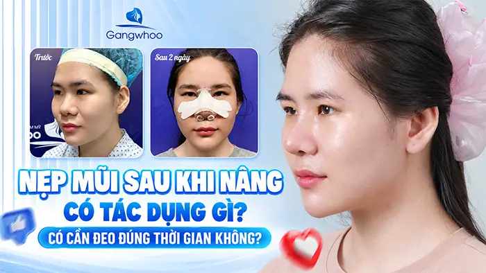 Nẹp Mũi Sau Khi Nâng Có Tác Dụng Gì? Có Cần Đeo Đúng Thời Gian Không?