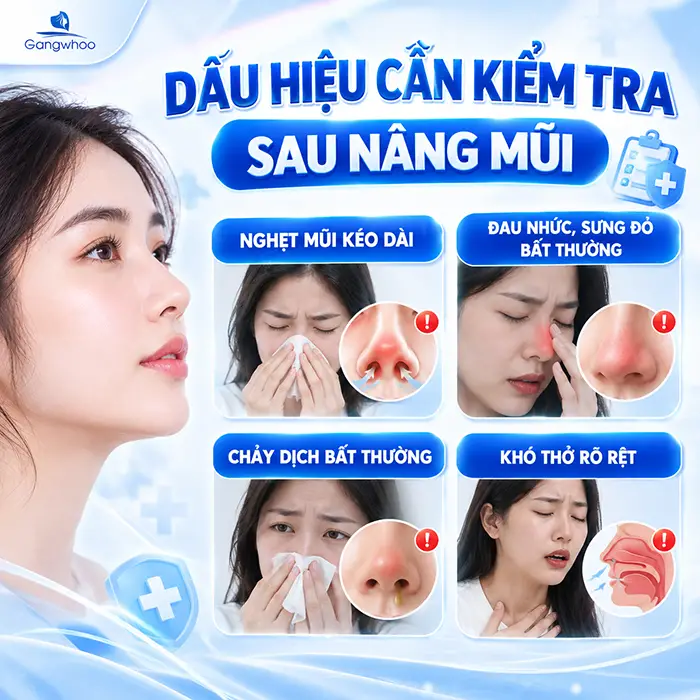 Nghẹt Mũi Sau Khi Nâng Mũi Có Sao Không? Khi Nào Cần Đi Kiểm Tra?