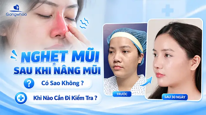 Nghẹt Mũi Sau Khi Nâng Mũi Có Sao Không? Khi Nào Cần Đi Kiểm Tra?