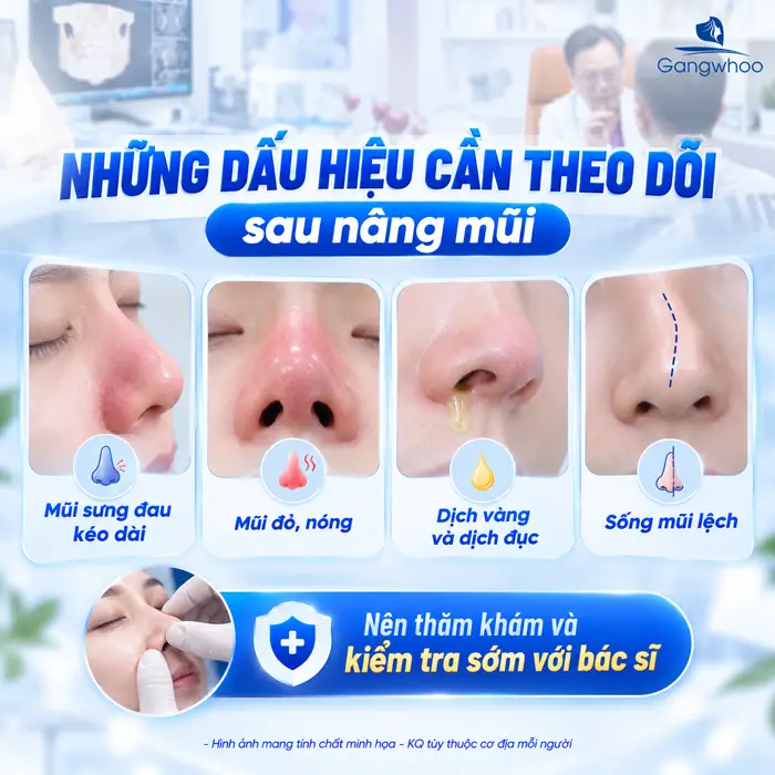 Những Hiện Tượng Sau Khi Nâng Mũi Thường Gặp Và Dấu Hiệu Cần Lưu Ý