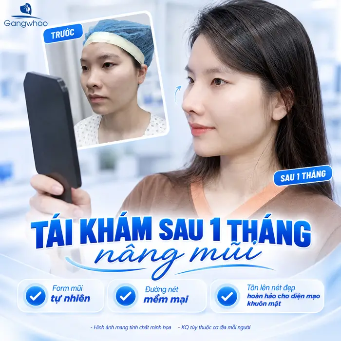 Quy Trình Nâng Mũi Gồm Những Bước Nào? Quá Trình Nâng Mũi Diễn Ra Ra Sao?
