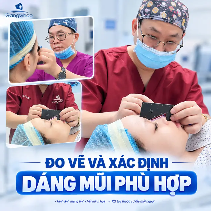 Quy Trình Nâng Mũi Gồm Những Bước Nào? Quá Trình Nâng Mũi Diễn Ra Ra Sao?