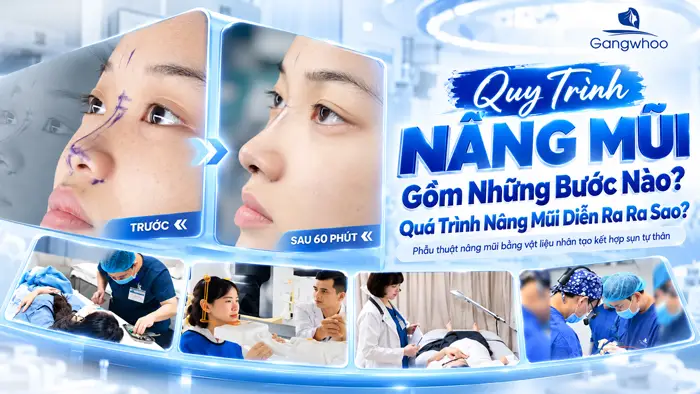 Quy Trình Nâng Mũi Gồm Những Bước Nào? Quá Trình Nâng Mũi Diễn Ra Ra Sao?
