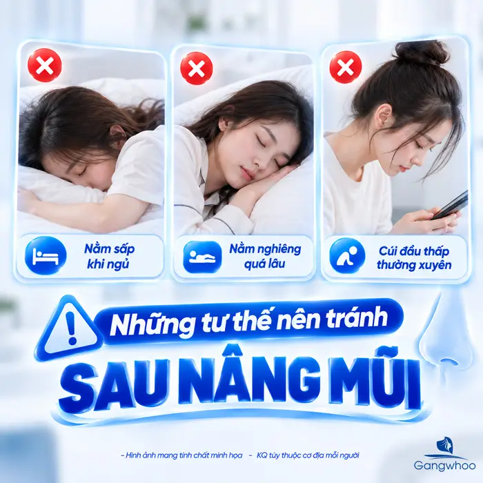 Sau Khi Nâng Mũi Nên Nằm Hay Ngồi? Tư Thế Nghỉ Ngơi Giúp Mũi Hồi Phục Ổn Định