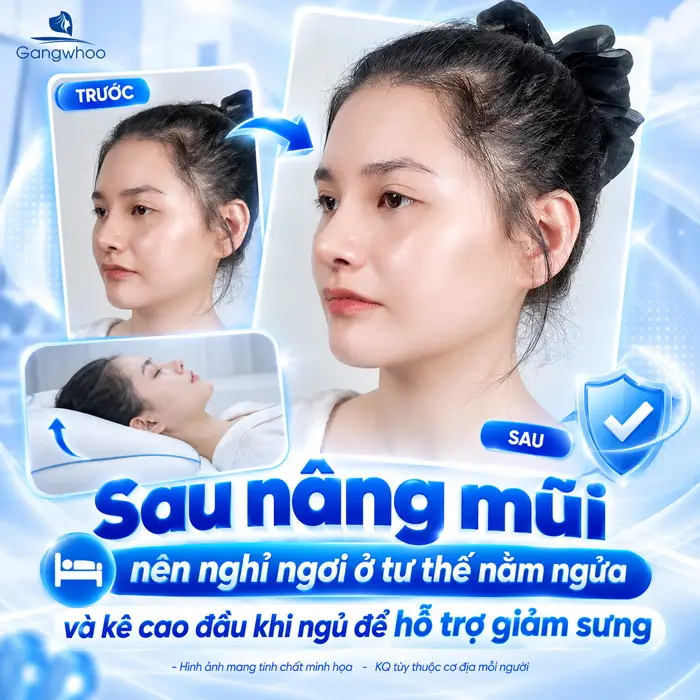 Sau Khi Nâng Mũi Nên Nằm Hay Ngồi? Tư Thế Nghỉ Ngơi Giúp Mũi Hồi Phục Ổn Định