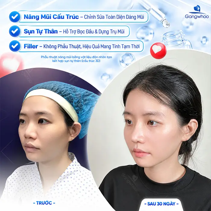 Serum Nâng Mũi Có Hiệu Quả Không? Có Nên Dùng Tinh Chất Nâng Mũi?