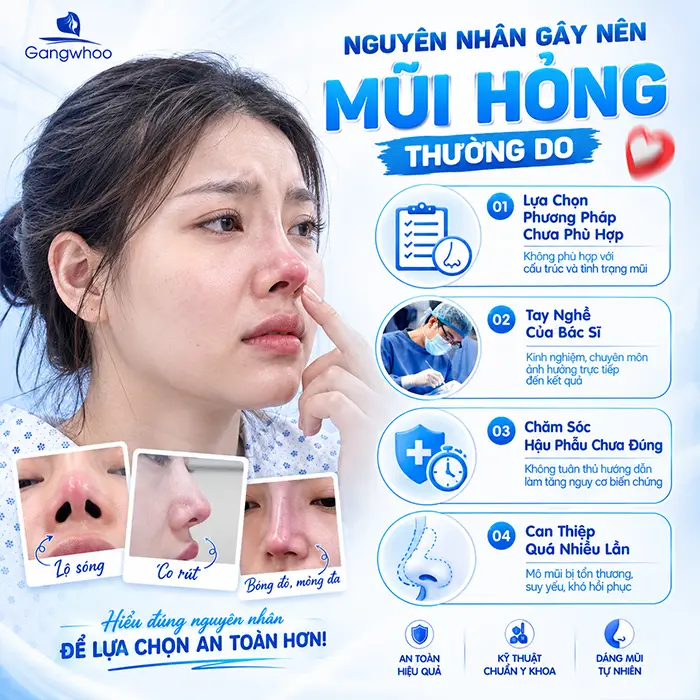 Sửa Lại Mũi Đã Nâng Có Đau Không? Khi Nào Cần Nâng Mũi Sửa Lại?