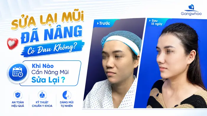 Sửa Lại Mũi Đã Nâng Có Đau Không? Khi Nào Cần Nâng Mũi Sửa Lại?