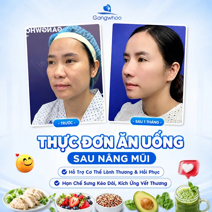 Thực Đơn Cho Người Mới Nâng Mũi Giúp Hồi Phục Nhanh Và Hạn Chế Sưng