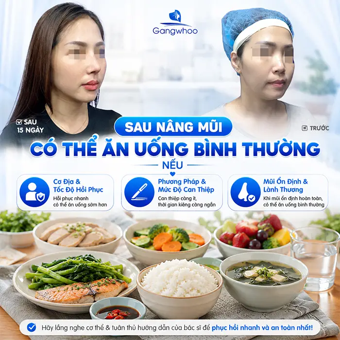Thực Đơn Cho Người Mới Nâng Mũi Giúp Hồi Phục Nhanh Và Hạn Chế Sưng