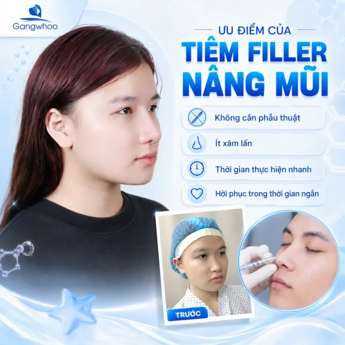 Tiêm Filler Nâng Mũi Có An Toàn Không? Những Điều Cần Biết Trước Khi Thực Hiện