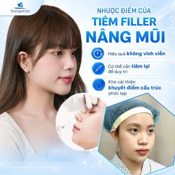Tiêm Filler Nâng Mũi Có An Toàn Không? Những Điều Cần Biết Trước Khi Thực Hiện