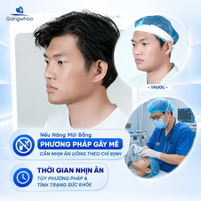 Trước Khi Nâng Mũi Nên Ăn Gì? Những Lưu Ý Ăn Uống Cần Biết