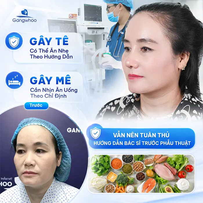 Trước Khi Nâng Mũi Nên Ăn Gì? Những Lưu Ý Ăn Uống Cần Biết