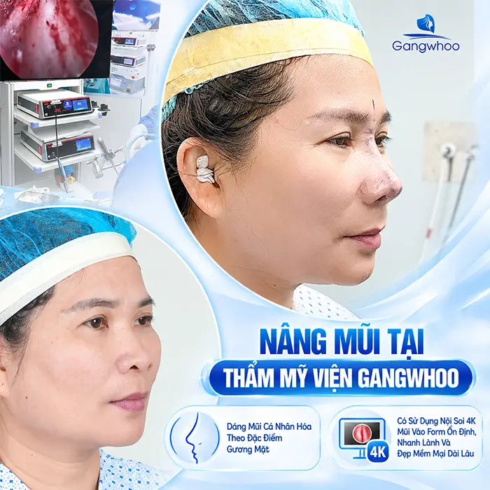 Những Trường Hợp Không Được Nâng Mũi? Các Bệnh Cần Lưu Ý Trước Khi Thẩm Mỹ
